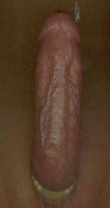 Rate Me