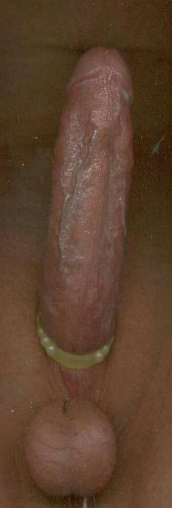 hard on
