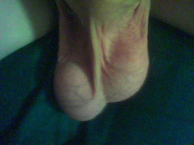 winkie