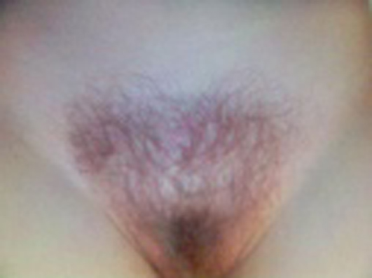 Rate Me