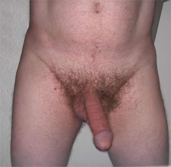 tbfent1